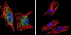 Invitrogen™ Glucocorticoid Receptor alpha Polyclonal Antibody