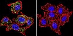 Invitrogen Glucocorticoid Receptor alpha Polyclonal Antibody 50 &mu;g;