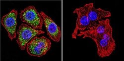 Invitrogen Glucocorticoid Receptor alpha Polyclonal Antibody 50 &mu;g;