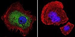 Invitrogen Glucocorticoid Receptor Monoclonal Antibody (BuGR2) 100 &mu;g;