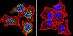 Invitrogen Glucocorticoid Receptor Polyclonal Antibody 50 &mu;g; Unconjugated:Antibodies,