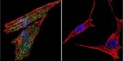 Invitrogen Glucocorticoid Receptor Polyclonal Antibody 50 &mu;g; Unconjugated:Antibodies,