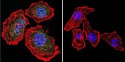 Invitrogen Glucocorticoid Receptor Polyclonal Antibody 50 &mu;g; Unconjugated:Antibodies,