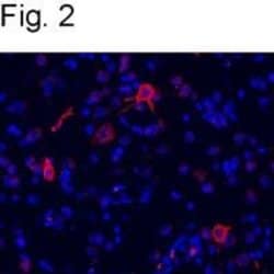 Invitrogen mGluR1 Polyclonal Antibody 100 &mu;g; Unconjugated:Antibodies,