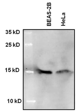 H2BK5ac Recombinant Superclonal Antibody (24HCLC):Antibodies, Recombinant