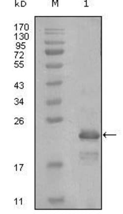 Invitrogen HAND1 Monoclonal Antibody (8E7A11,8C2F4) 100 &mu;L; Unconjugated:Antibodies,