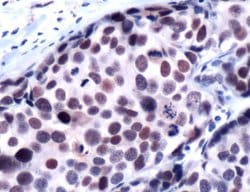 Invitrogen HDAC1 Polyclonal Antibody 500 &mu;L; Unconjugated:Antibodies,