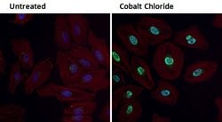 Invitrogen HIF1A Polyclonal Antibody 100 &mu;L; Unconjugated:Antibodies,