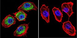 Invitrogen HIF-1 beta Monoclonal Antibody (2B10) 100 &mu;L; Unconjugated:Antibodies,
