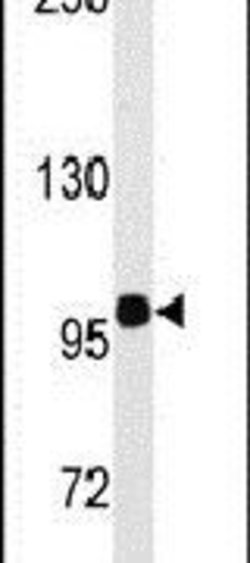HIPK2 Rabbit anti-Human, Polyclonal, Invitrogen 400 &mu;L; Unconjugated:Antibodies,