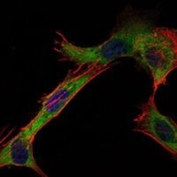 Invitrogen HK1 Monoclonal Antibody (7A7) 100 &mu;L; Unconjugated:Antibodies,