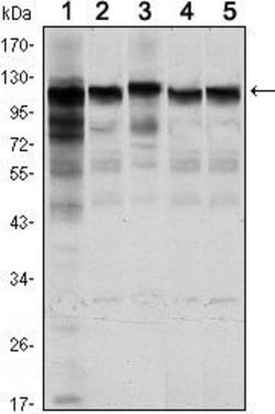 Invitrogen HK1 Monoclonal Antibody (7A7) 100 &mu;L; Unconjugated:Antibodies,
