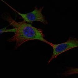 HK1 Monoclonal Antibody (3A10):Antibodies, Monoclonal