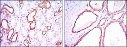 HK1 Monoclonal Antibody (3A10):Antibodies, Monoclonal