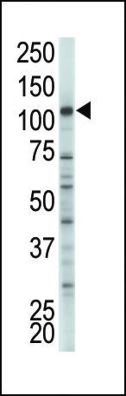 HK2 Rabbit anti-Human, Polyclonal, Invitrogen 400 &mu;L; Unconjugated:Antibodies,