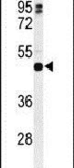 HLA-DRB5 Rabbit anti-Human, Polyclonal, Invitrogen 400 &mu;L; Unconjugated:Antibodies,