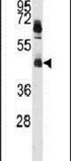 hnRNP K Rabbit anti-Human, Mouse, Polyclonal, Invitrogen 400 &mu;L; Unconjugated:Antibodies,
