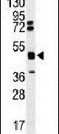 hnRNP K Rabbit anti-Human, Mouse, Polyclonal, Invitrogen 400 &mu;L; Unconjugated:Antibodies,