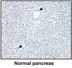 NGAL Monoclonal Antibody (5G5), Invitrogen 200 &mu;L; Unconjugated:Antibodies,