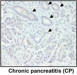 NGAL Monoclonal Antibody (5G5), Invitrogen 200 &mu;L; Unconjugated:Antibodies,