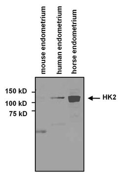 Invitrogen HK2 Polyclonal Antibody 100 &mu;L; Unconjugated:Antibodies,