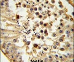 H3K9me2 Polyclonal Antibody, Invitrogen 400 &mu;L; Unconjugated:Antibodies,