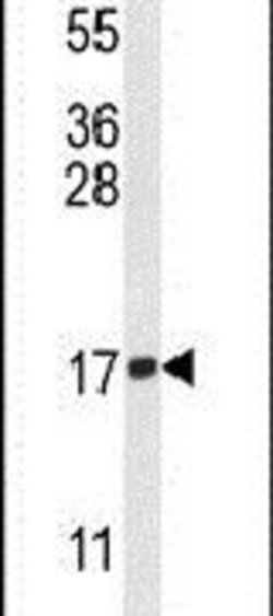 H3K9me2 Polyclonal Antibody, Invitrogen 400 &mu;L; Unconjugated:Antibodies,