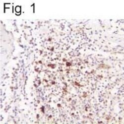Invitrogen HHV-6 Envelope Monoclonal Antibody (F59G) 1 mL; Unconjugated:Antibodies,