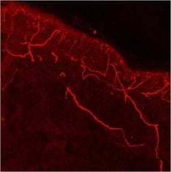 Invitrogen TRPV1 Polyclonal Antibody 100 &mu;g; Unconjugated:Antibodies,