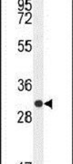 CTLA-4 Rabbit anti-Human, Polyclonal, Invitrogen 200 &mu;L | Buy Online | Invitrogen | Fisher Scientific