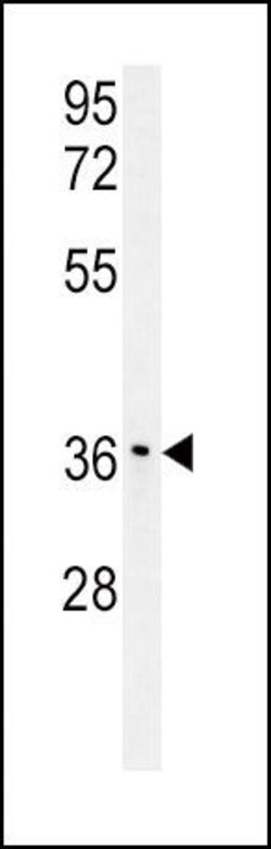 IGFBP3 Polyclonal Antibody, Invitrogen 400 &mu;L | Buy Online | Invitrogen | Fisher Scientific