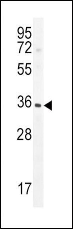 IGFBP3 Polyclonal Antibody, Invitrogen 400 &mu;L | Buy Online | Invitrogen | Fisher Scientific