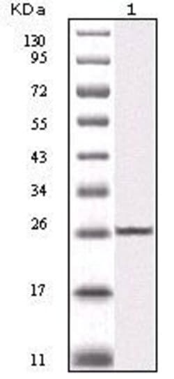 Invitrogen IKK beta Monoclonal Antibody (10A2C5B3) 100 &mu;L; Unconjugated:Antibodies,