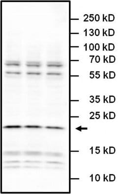 Invitrogen IL-6 Polyclonal Antibody 1 mg; Unconjugated:Antibodies, Polyclonal