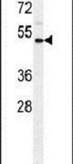 IL1R2 Rabbit anti-Human, Polyclonal, Invitrogen 400 &mu;L; Unconjugated:Antibodies,