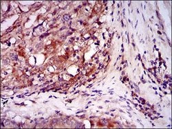 Invitrogen ILK Monoclonal Antibody (3A9) 100 &mu;L; Unconjugated:Antibodies,