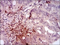 Invitrogen ILK Monoclonal Antibody (3A9) 100 &mu;L; Unconjugated:Antibodies,