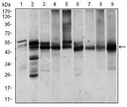 Invitrogen ILK Monoclonal Antibody (3A9) 100 &mu;L; Unconjugated:Antibodies,