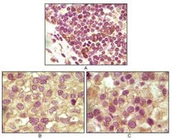 INHA Monoclonal Antibody (4A2), Invitrogen 100 &mu;g; Unconjugated:Antibodies,