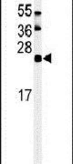 ISG15 Rabbit anti-Human, Polyclonal, Invitrogen 400 &mu;L; Unconjugated:Antibodies,