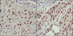 Invitrogen ISL1 Monoclonal Antibody (1H9) 100 &mu;L; Unconjugated:Antibodies,