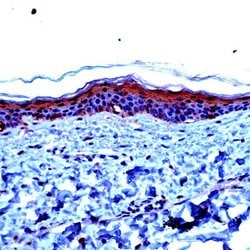 Invitrogen Involucrin Polyclonal Antibody 1 mL; Unconjugated:Antibodies,