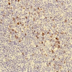 J Chain Rabbit anti-Human, Polyclonal, Invitrogen 500 &mu;L; Unconjugated:Antibodies,