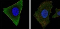 Invitrogen JAK3 Monoclonal Antibody (5H2) 100 &mu;L; Unconjugated:Antibodies,