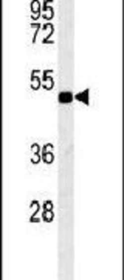 KCNV1 Polyclonal Antibody, Invitrogen 400 &mu;L; Unconjugated:Antibodies,
