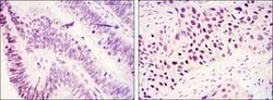 JMJD1A Monoclonal Antibody (1E12):Antibodies, Monoclonal