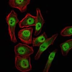 Invitrogen JMJD2A Monoclonal Antibody (5H1) 100 &mu;L; Unconjugated:Antibodies,