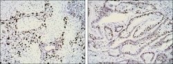 Invitrogen Ki-67 Monoclonal Antibody (8D5) 100 &mu;L; Unconjugated:Antibodies,