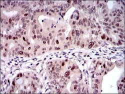 Invitrogen KID Monoclonal Antibody (1E3) 100 &mu;L; Unconjugated:Antibodies,