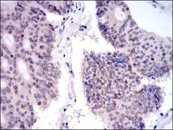 Invitrogen KID Monoclonal Antibody (1E3) 100 &mu;L; Unconjugated:Antibodies,